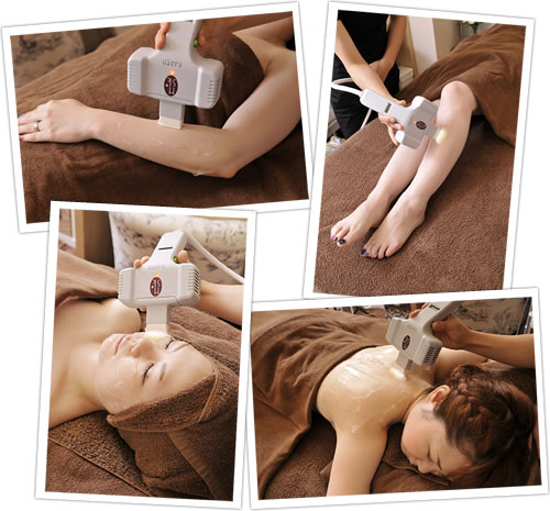 ハイパースキン脱毛を受ける施術風景の写真