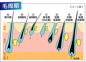 ハイパースキン脱毛法の脱毛技術を解説する毛周期のイラスト画像