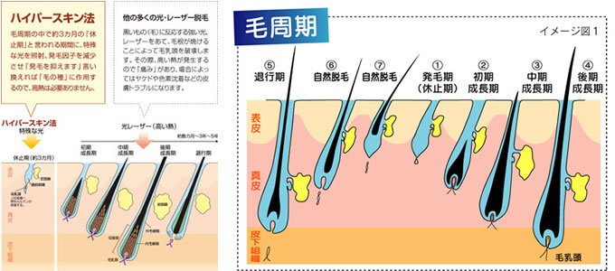 ハイパースキン法と毛周期について